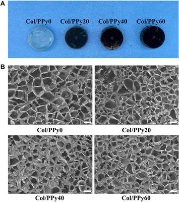 Conductive Collagen-Based Hydrogel Combined With Electrical Stimulation to Promote Neural Stem Cell Proliferation and Differentiation